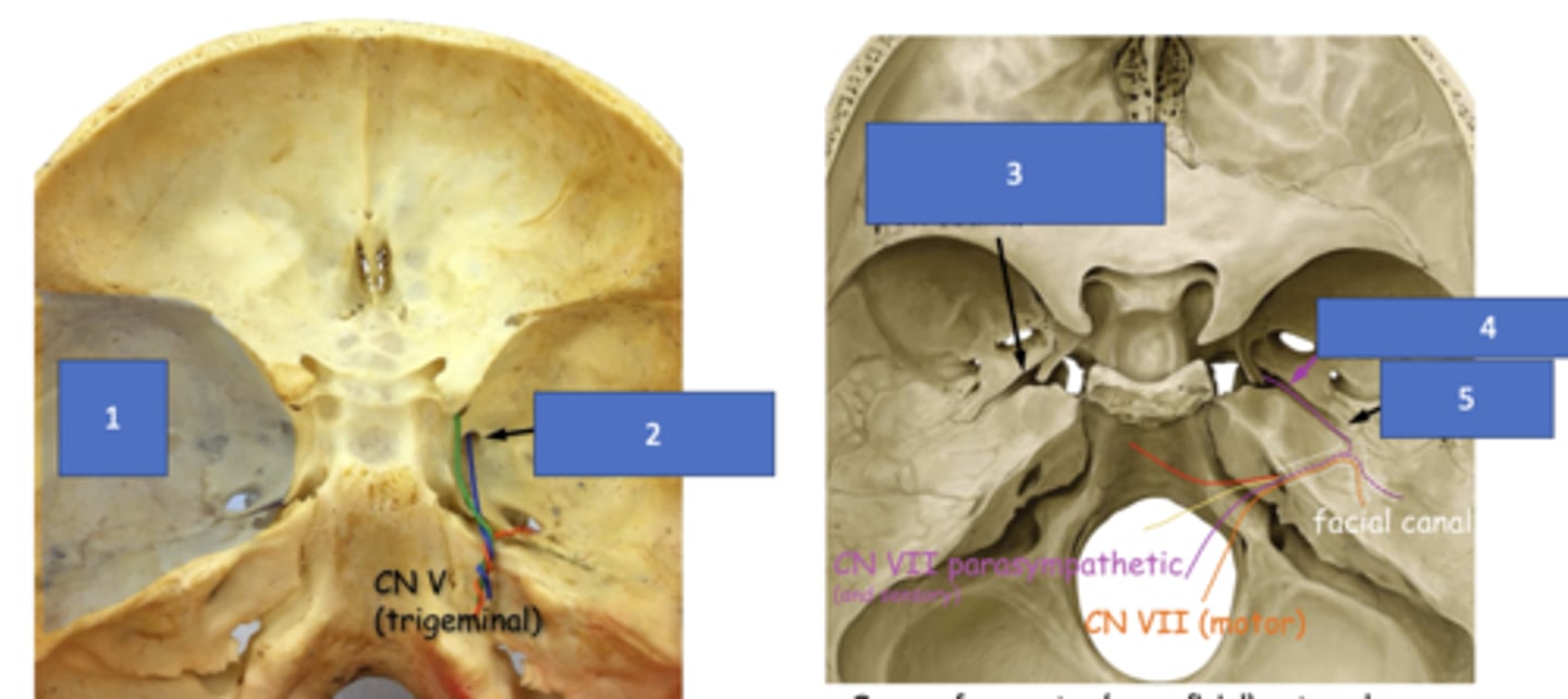<p>Identify the structure at #1</p>