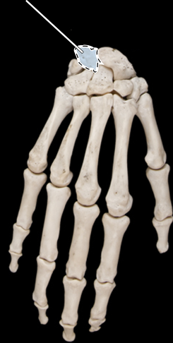 <p>Bones of the hand, posterior view, right sid</p>