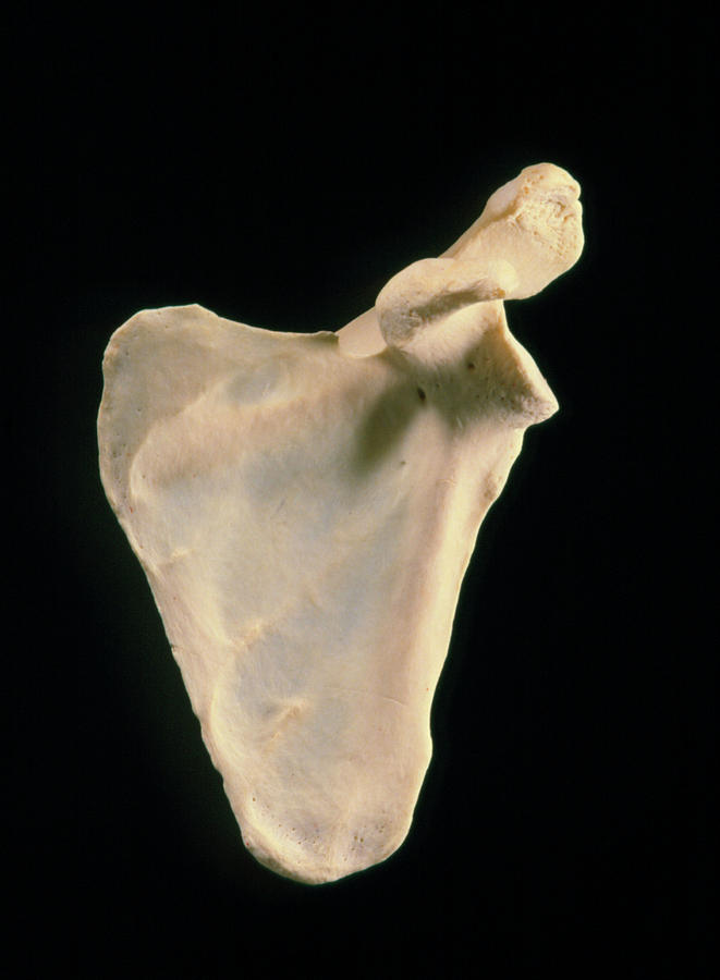 <p>Is this scapula posterior or anterior?</p>