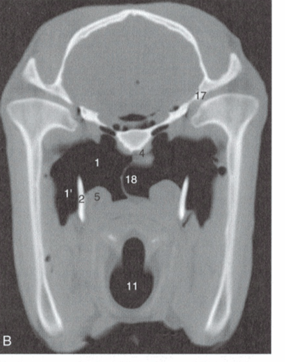 <p>- "Draped" over the stylohyoid bone</p><p>- Forms medial and lateral compartments</p>