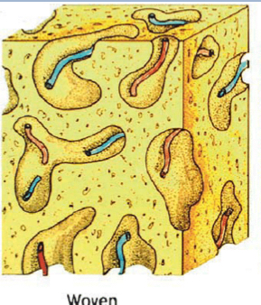 <p>Arrangement of immature bone</p><p>Found in juvenile/developing bones and early fracture repair</p>