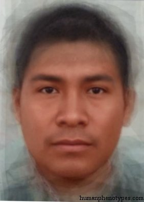 <p>Identify this Phenotype</p>