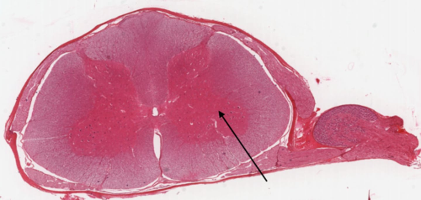 <p>Identify the part of the spinal cord</p>