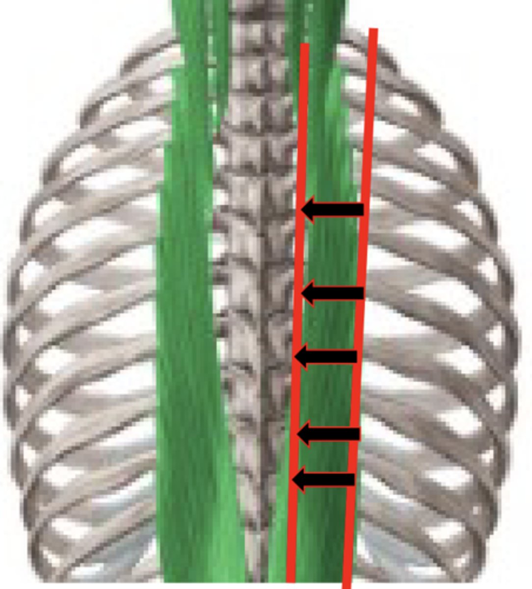 <p>Strumming</p><p>- Sliding OVER muscle</p><p>- Finding trigger points</p><p>- Feeling differences</p>