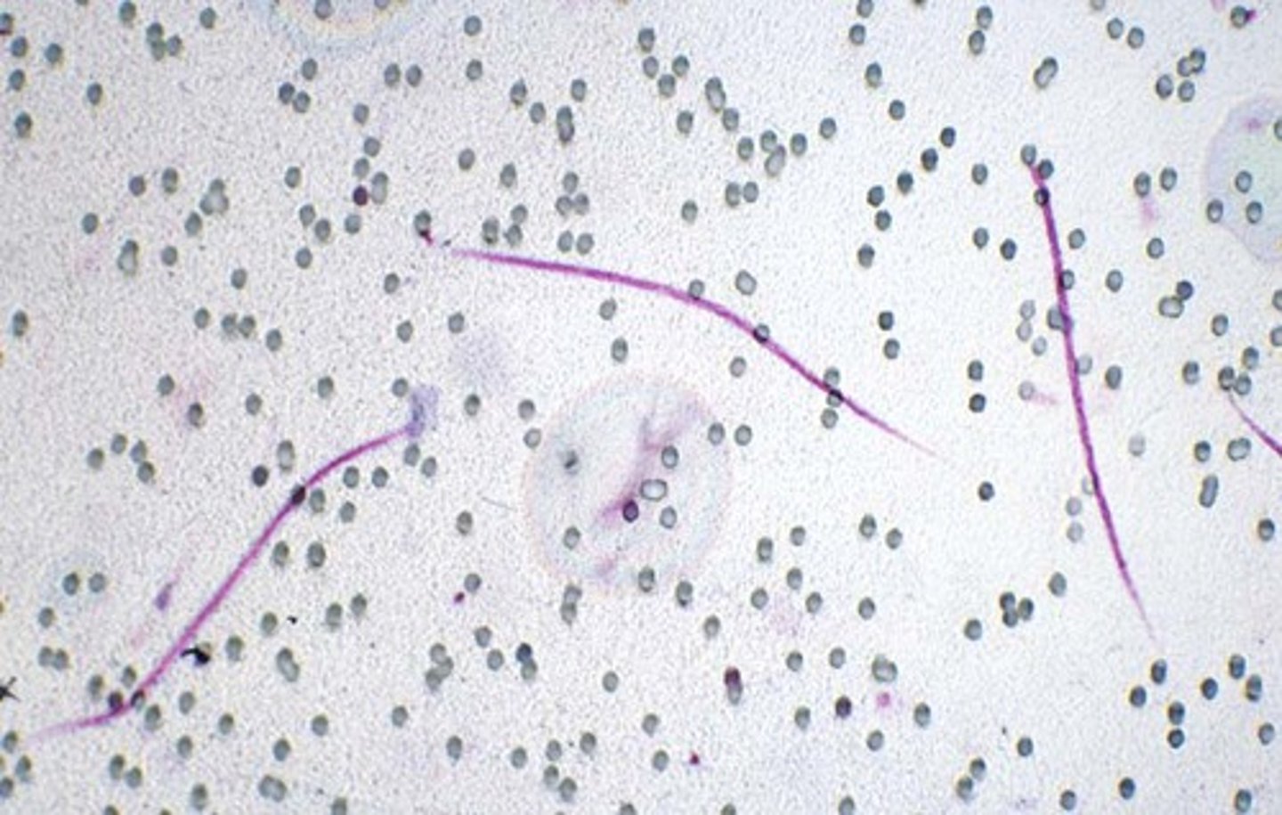 <p>The larval stage of the heartworm.</p>