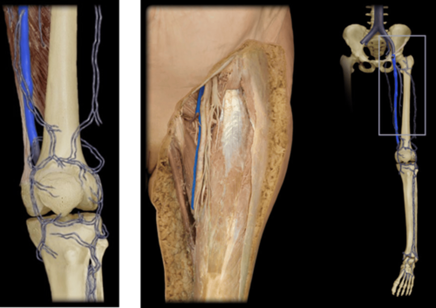 <p>Name this vessel that becomes the popliteal vein.</p>