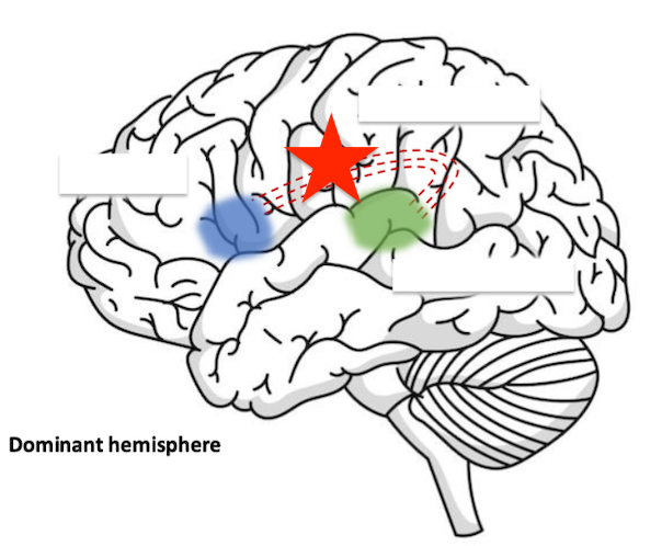 <p>damage to this area would cause? (arcuate fasciculus) </p>