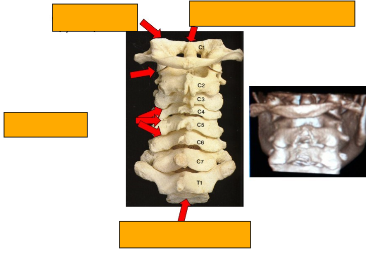 <p>Label clockwise </p>