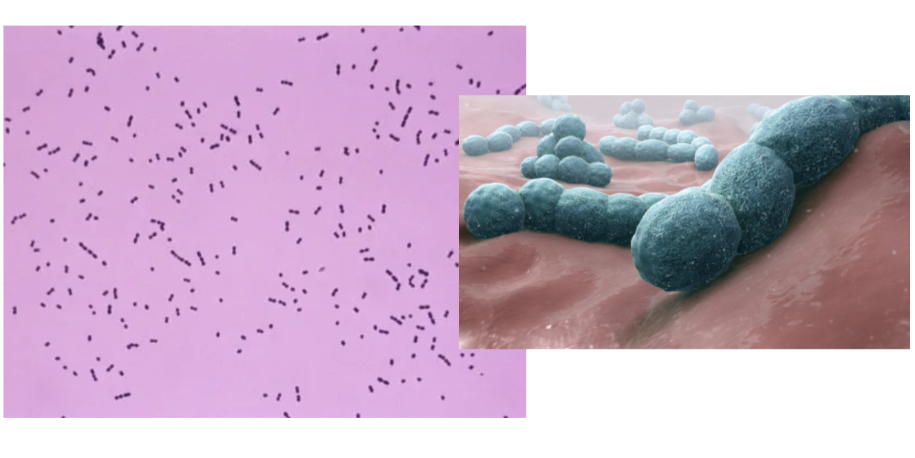 <p>What is this bacteria and what disease does it cause?</p>