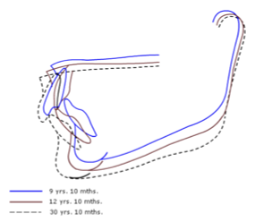 <p>Björk’s findings pt. 1</p>