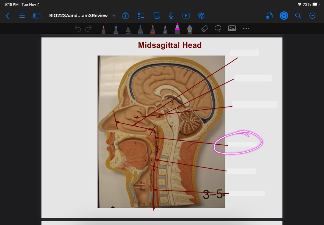 <p>What is this?</p>