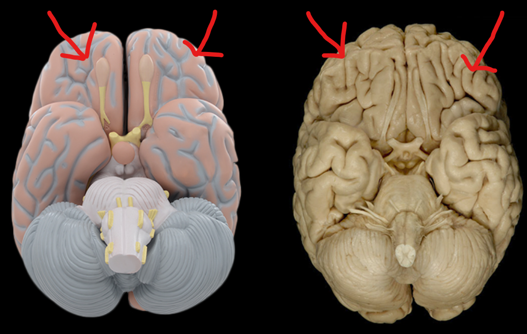 <p>What lobe is this?</p>