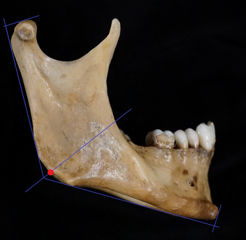 <p>Point along rounded posteroinferior corner of the mandible between the ramus and body&nbsp;</p>