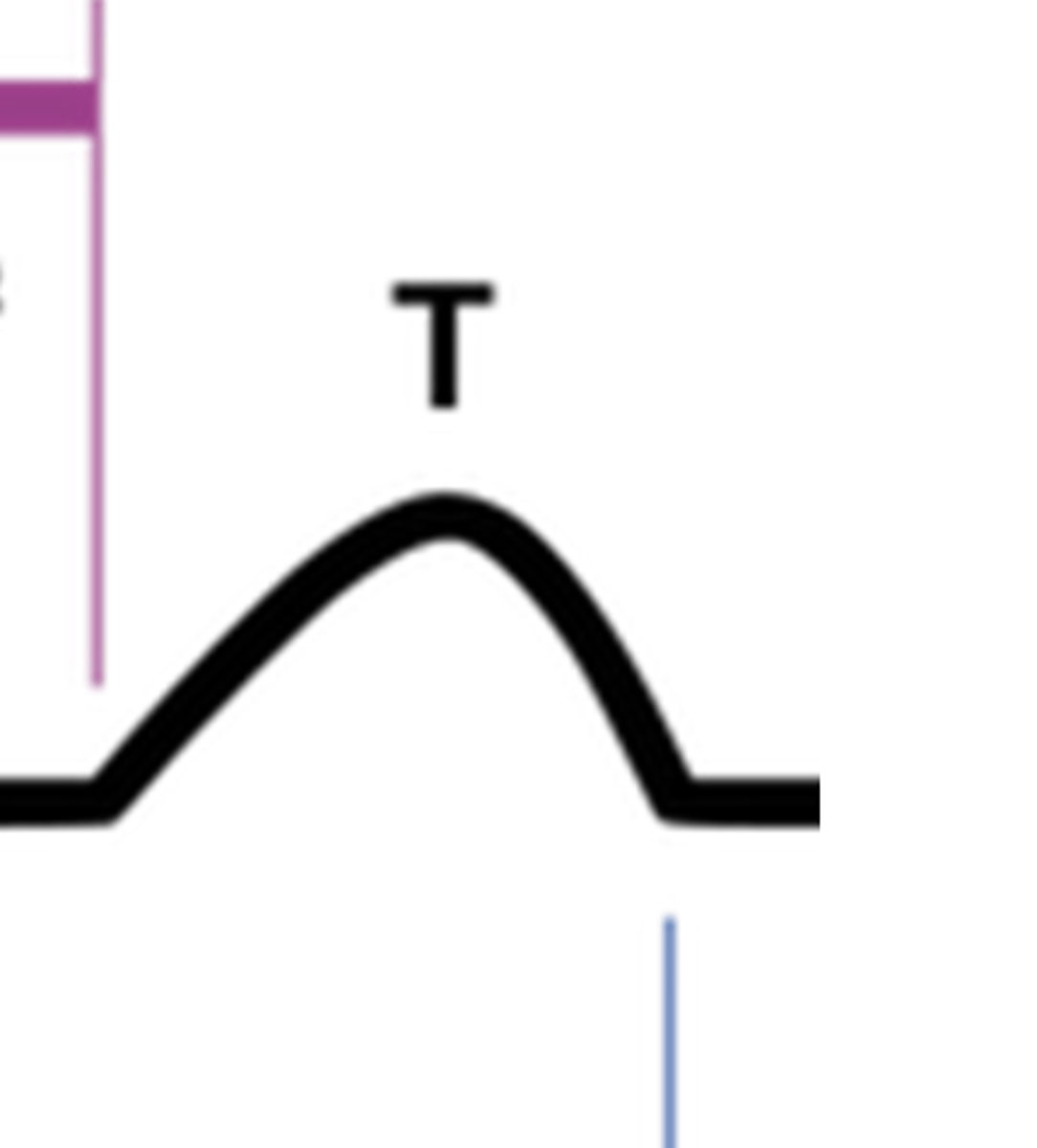 <p>ventricular repolarization</p>