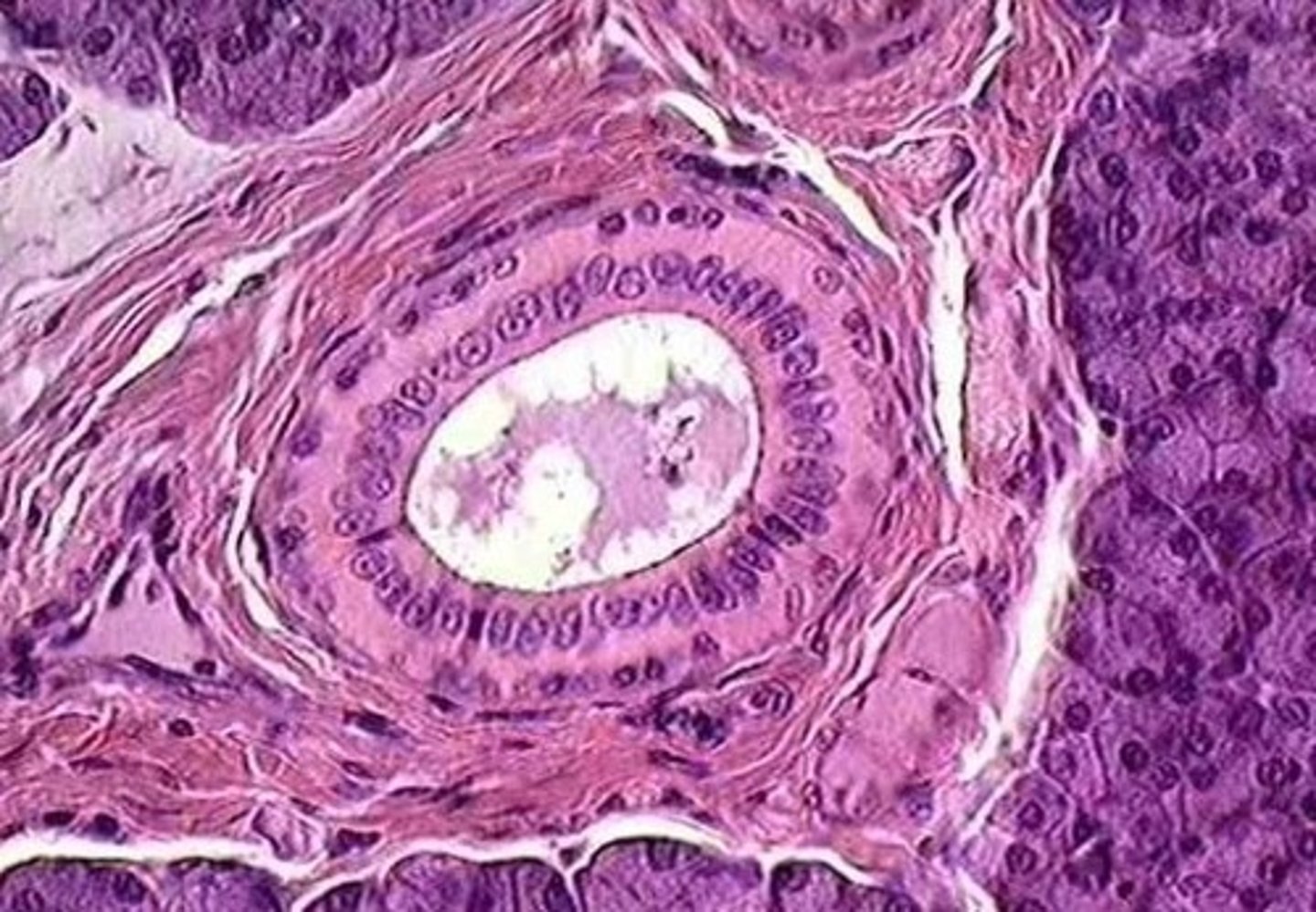 <p>large interlobular duct of submaxillary gland</p>