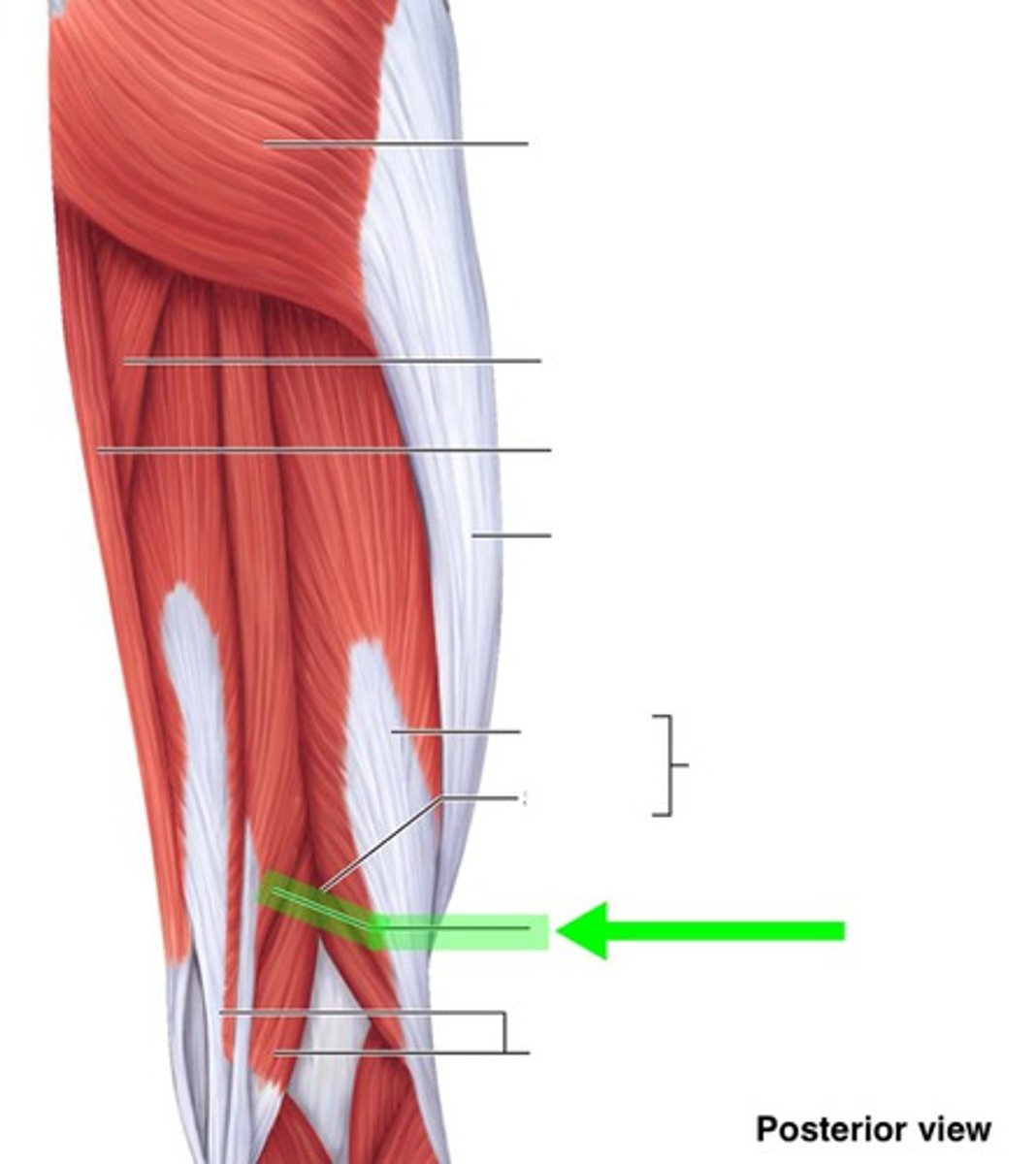 <p>What muscle is this?</p>