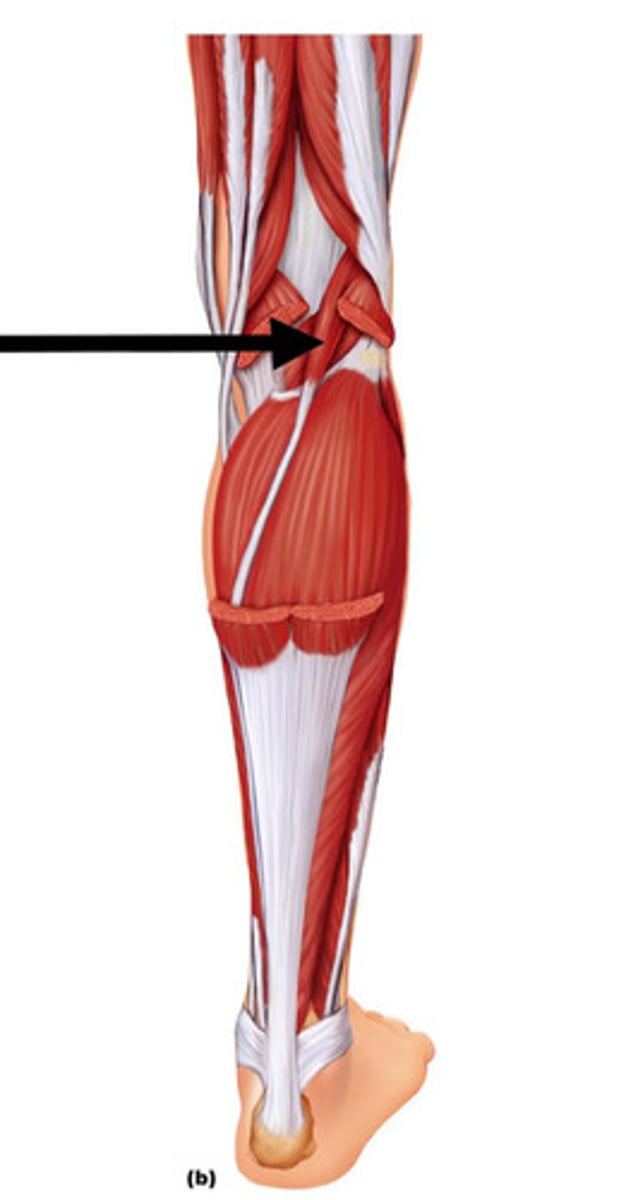 <p>A: Plantar flexion of food; flexion of leg</p><p>O: distal shaft of femur</p><p>I: calcaneus</p>