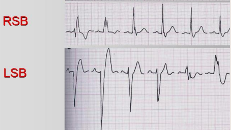 <p>Blocul de ramură</p>