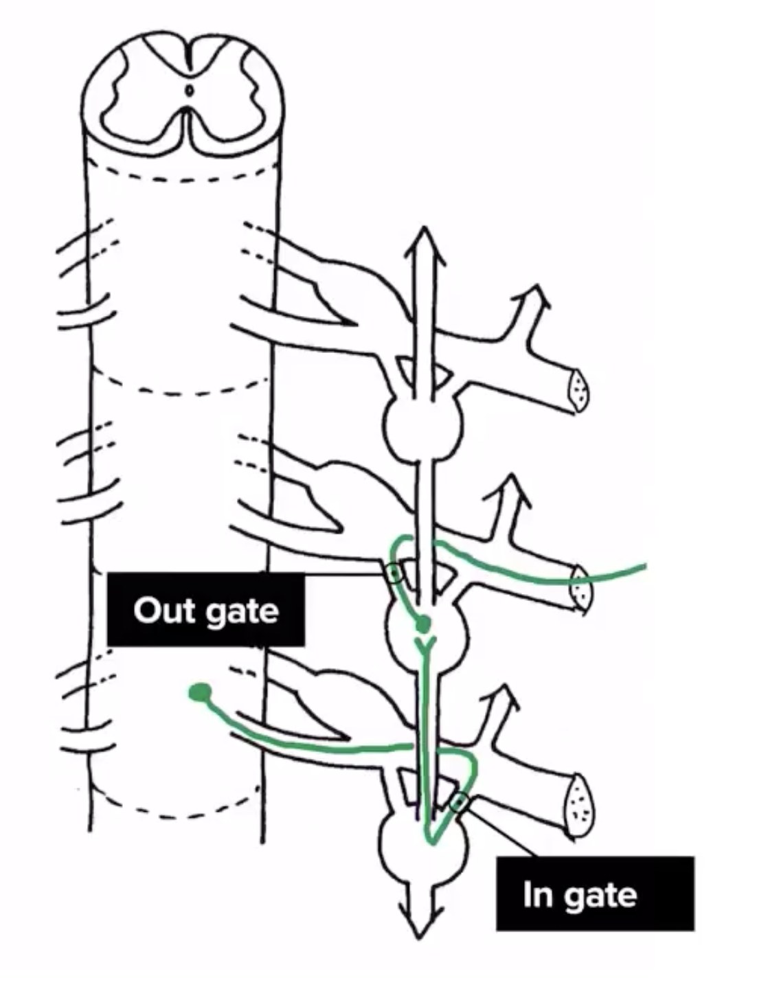 <p><strong><em>Thoracomlumbar outflow:</em></strong></p><ul><li><p>Neurons only exit from the <strong><em>lateral horn</em></strong> of spinal segments</p></li></ul><p></p><ol><li><p>Sympathetic motor neurons originate from the lateral horns of T1-L2 spinal segments</p></li><li><p>Information travels to the <strong><em><u>sympathetic chain</u></em></strong>&nbsp;via the<strong><em><u> pre-ganglionic neuron</u></em></strong></p></li><li><p><strong><em><u>Pre-ganglionic neuron</u></em></strong>&nbsp;synapses with the<strong><em><u> post-ganglionic neuron&nbsp;</u></em></strong>&nbsp;in the sympathetic ganglion which makes up the sympathetic chain <mark data-color="purple" style="background-color: purple; color: inherit;">via the ingate</mark></p></li><li><p>&nbsp;<strong><em><u>post-ganglionic neuron</u></em></strong>&nbsp;goes out to innervate viscera via <mark data-color="purple" style="background-color: purple; color: inherit;">the out gate</mark></p></li></ol><p></p>