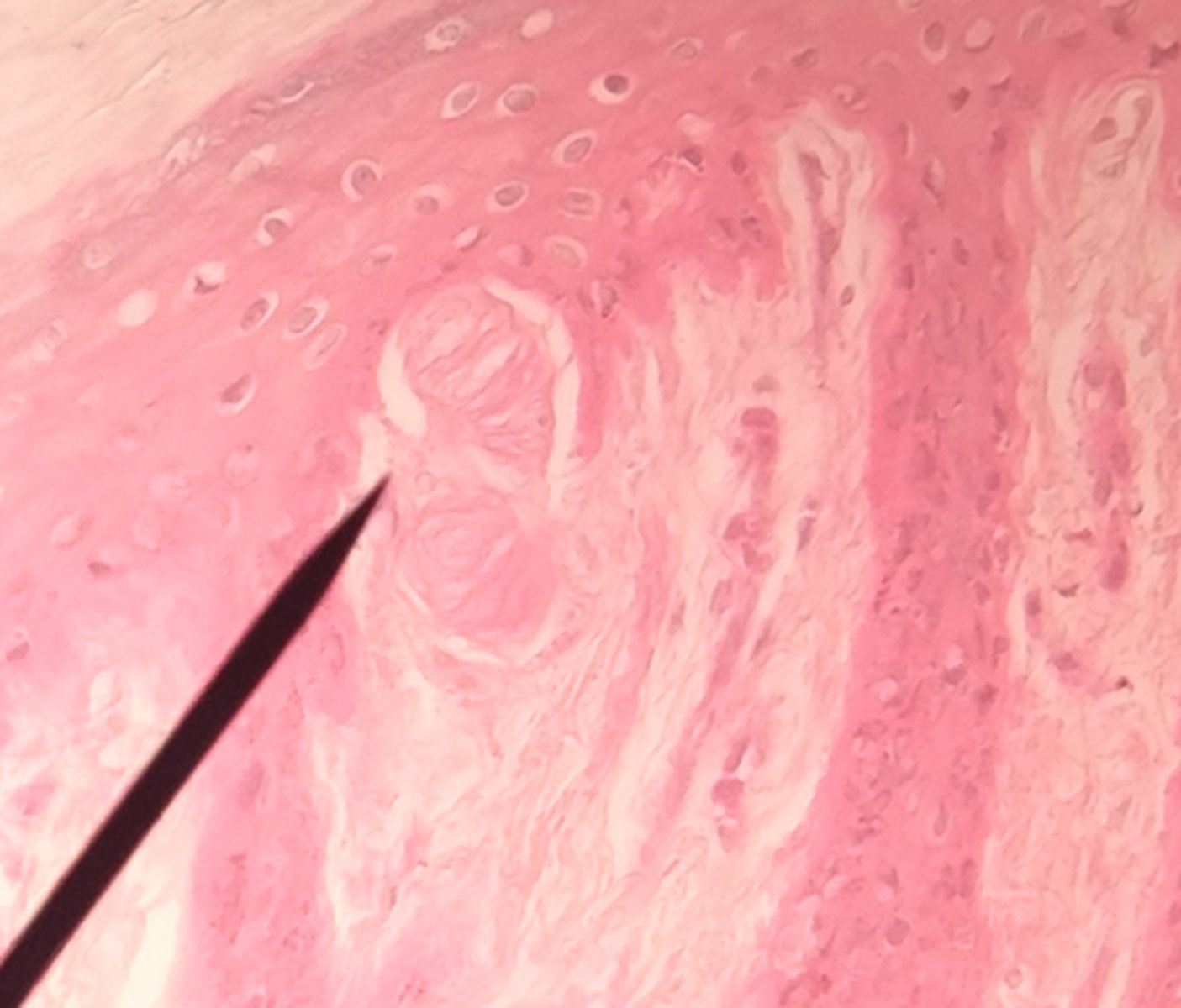 <p>General: Somatic:</p><p>Tactile aka Corpuscles of Touch; found in dermal papillae of the dermis; its capsule detects the onset of touch; some detection of low-frequency vibration; abundant in fingertips, hands, eyelids tip of tongue, lips, nipples, soles,</p><p>clitoris, tip of penis</p>