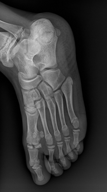 <p>Describe the abnormality demonstrated.</p>