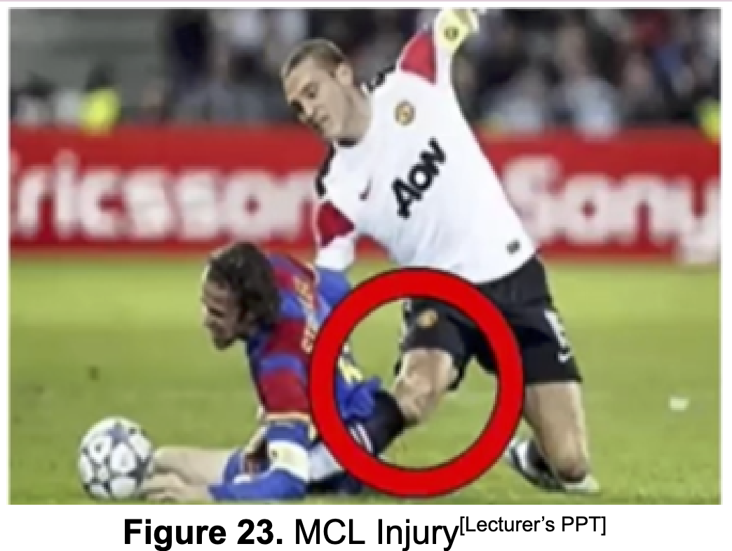 <p>MEDIAL COLLATERAL LIGAMENT!</p>