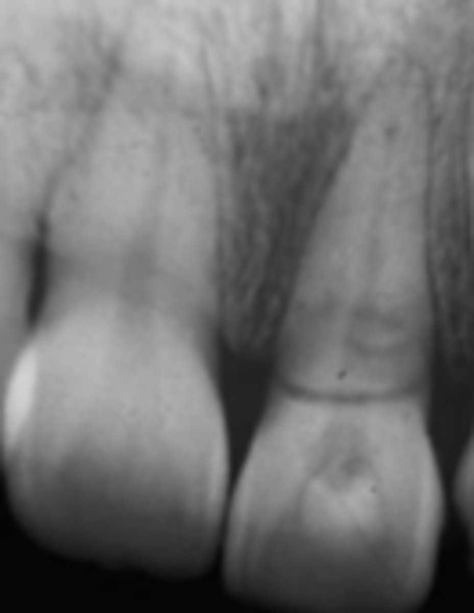 <p>Which trauma:</p>