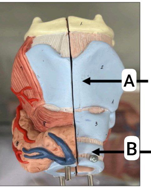 <p>Identify the following and answer these questions</p><p></p><ul><li><p>Identify the tube</p></li></ul><p></p><ul><li><p>Identify its beginning</p></li></ul><p></p><ul><li><p>Where does it end</p></li></ul><p></p><ul><li><p>identify the mode of termination</p></li></ul><p></p>