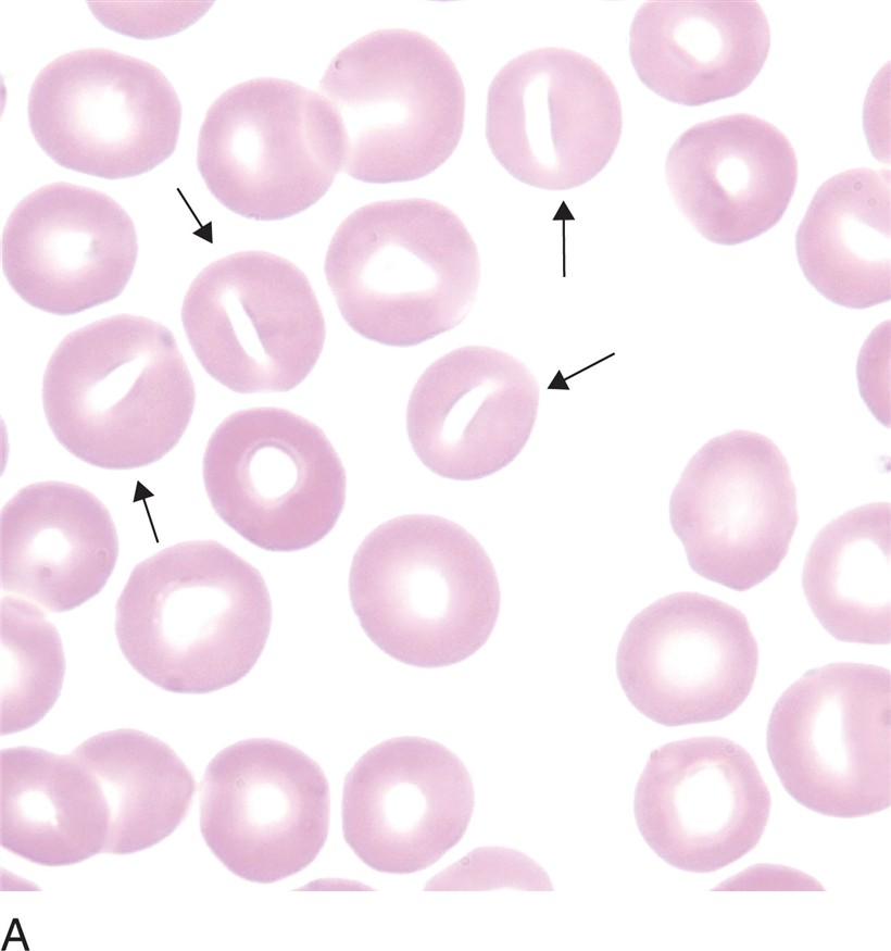 <p>what is a stomatocyte (mouth cell)?</p>
