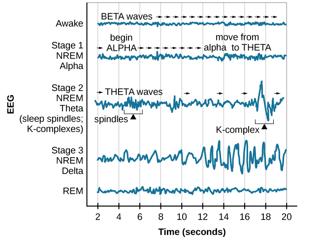 <p>stage 1: NREM</p>