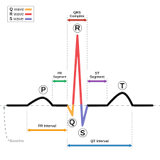 <p>Rhythm strip interpretation</p>
