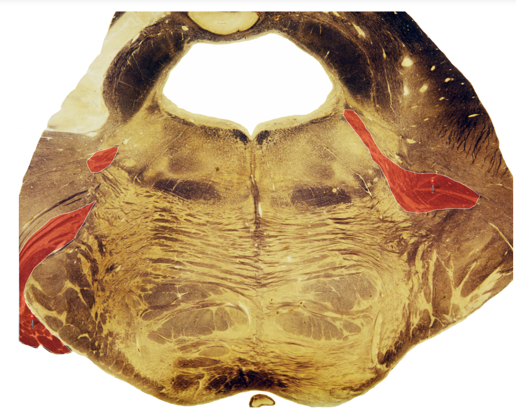 <p>Trigeminal Nerve </p>