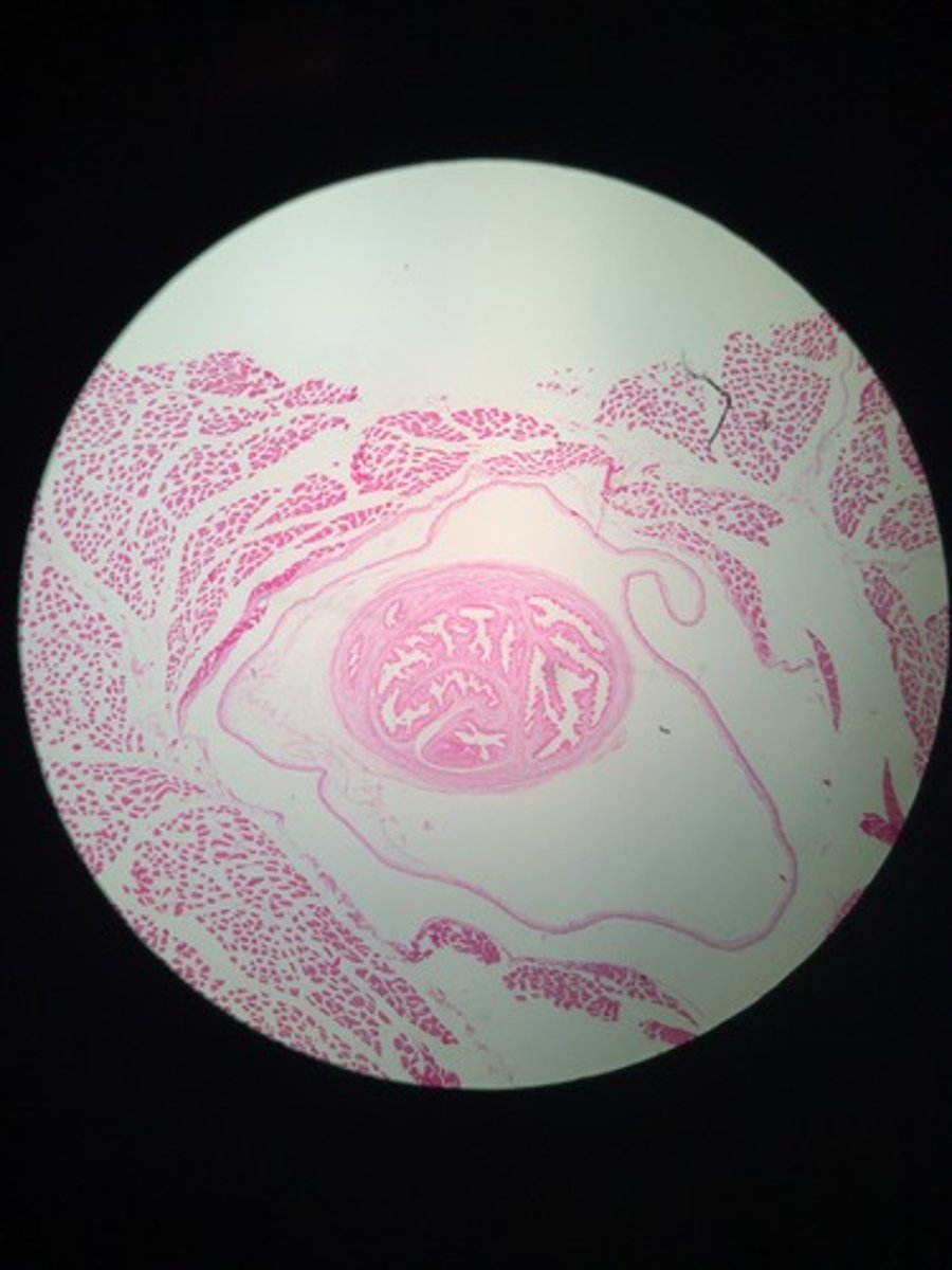 <p>-a.k.a. a bladder worm -</p><p>-a larval tapeworm in which the scolex is inverted in a sac</p><p>-usually in skeletal muscle/meat of host</p>