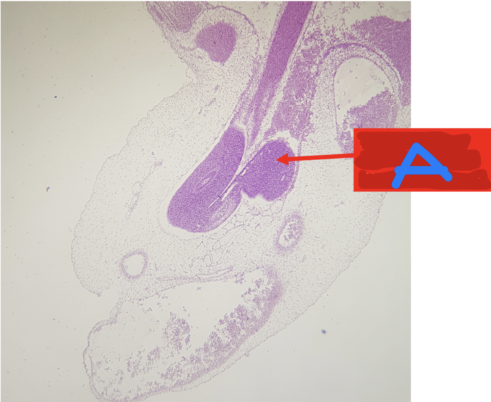 <p>Identify the structure</p>