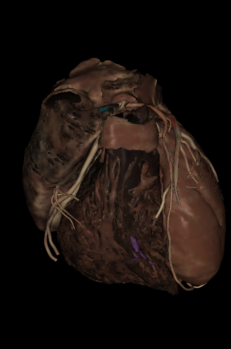 <p>Name the structure highlighted </p>