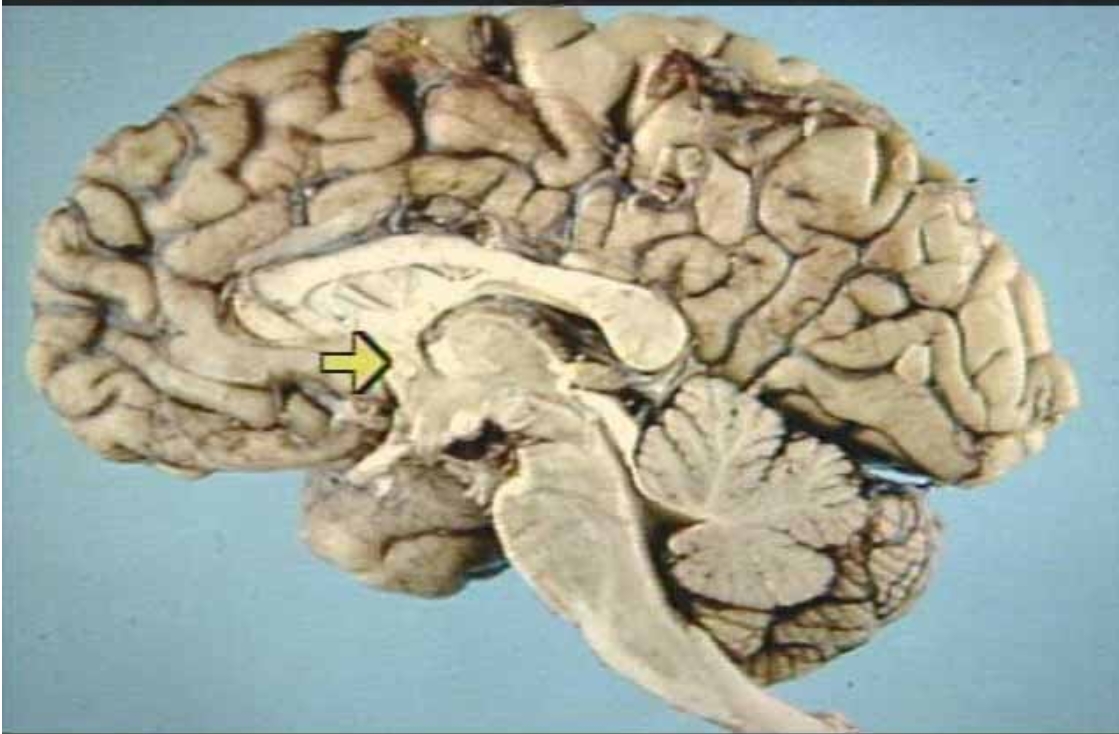 <p>What is the arrow pointing at?</p>