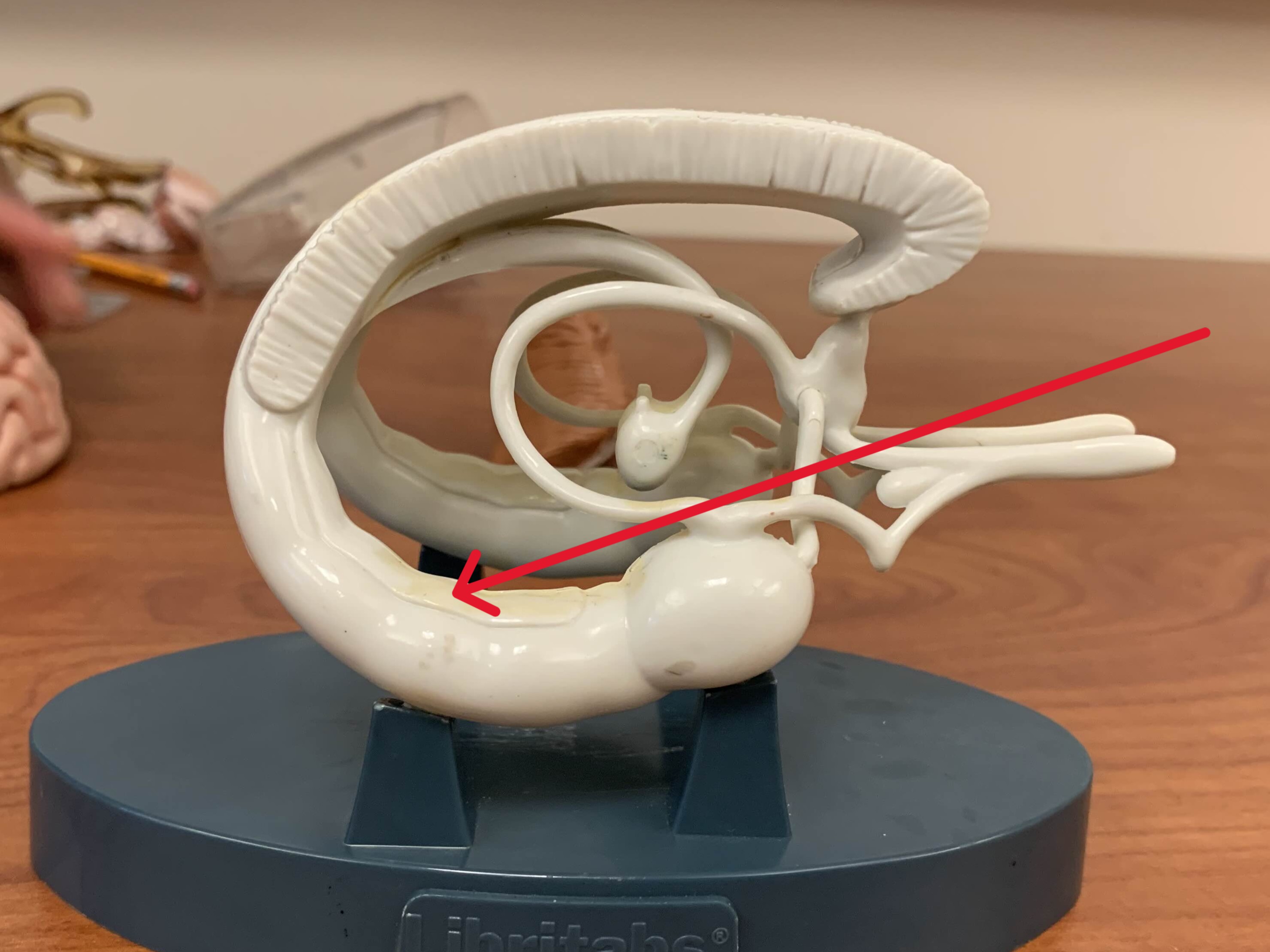 <p>Which part of the brain is:</p><ul><li><p>Seahorse-shaped, bumpy worm</p></li><li><p>Inferior thalamus</p></li></ul><p></p>