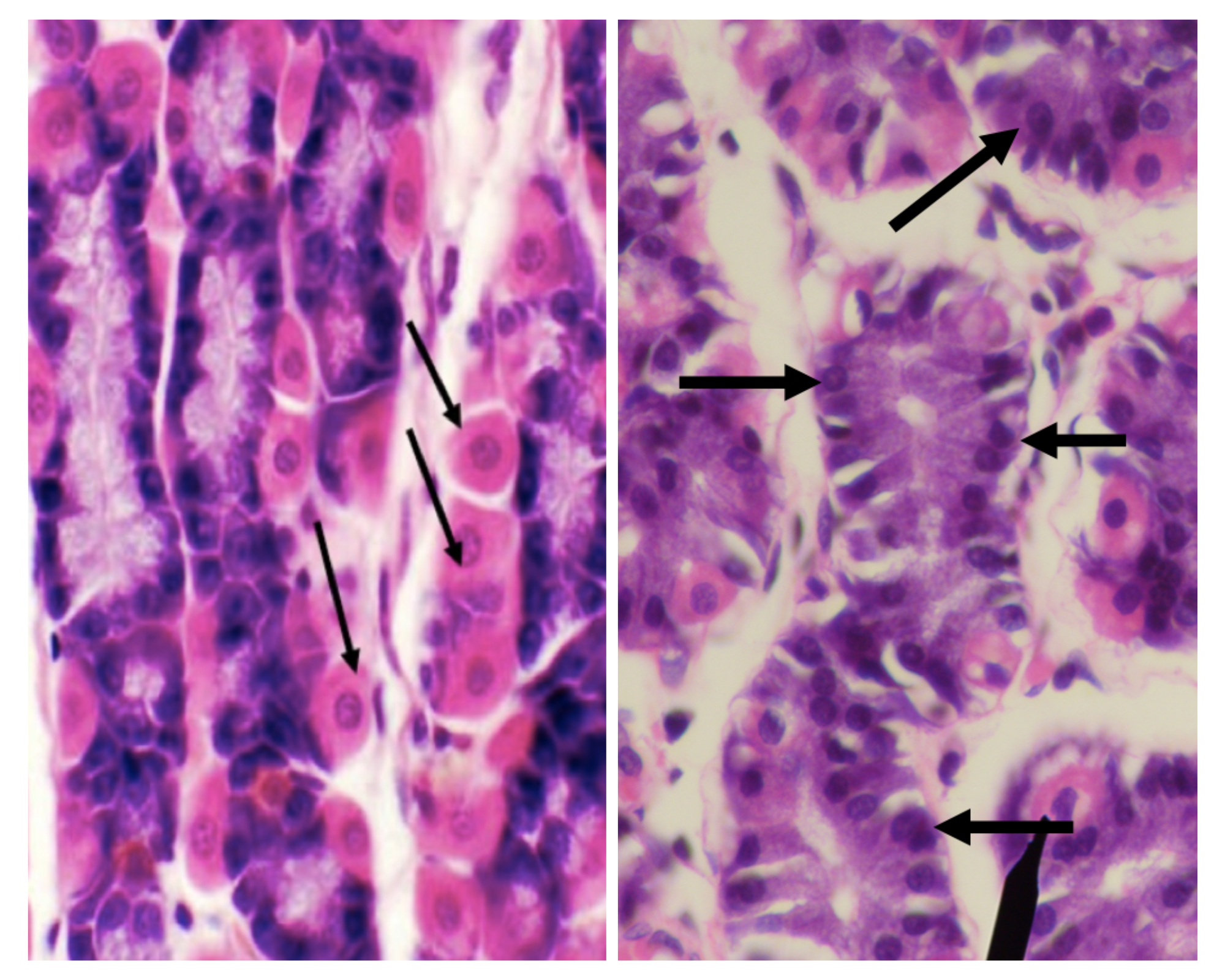 <p>Which among the two cells is basophilic in staining?</p>