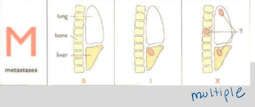<p>M stands for metastases, which indicates the number of areas affected by cancerous cells or tumors.</p>