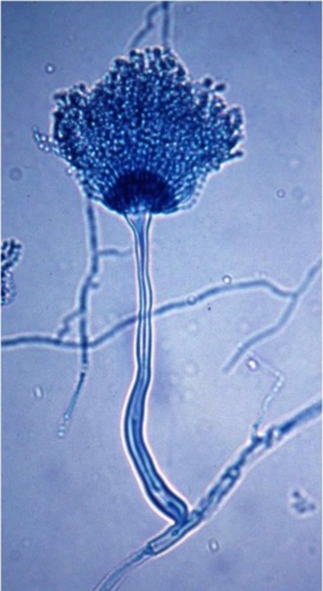 <p>looks like feather duster (all structures stem from one area) and posses a foot cell at its base</p>