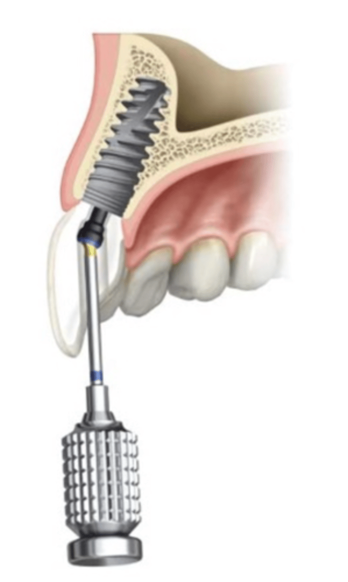 <p>ID the part:</p>