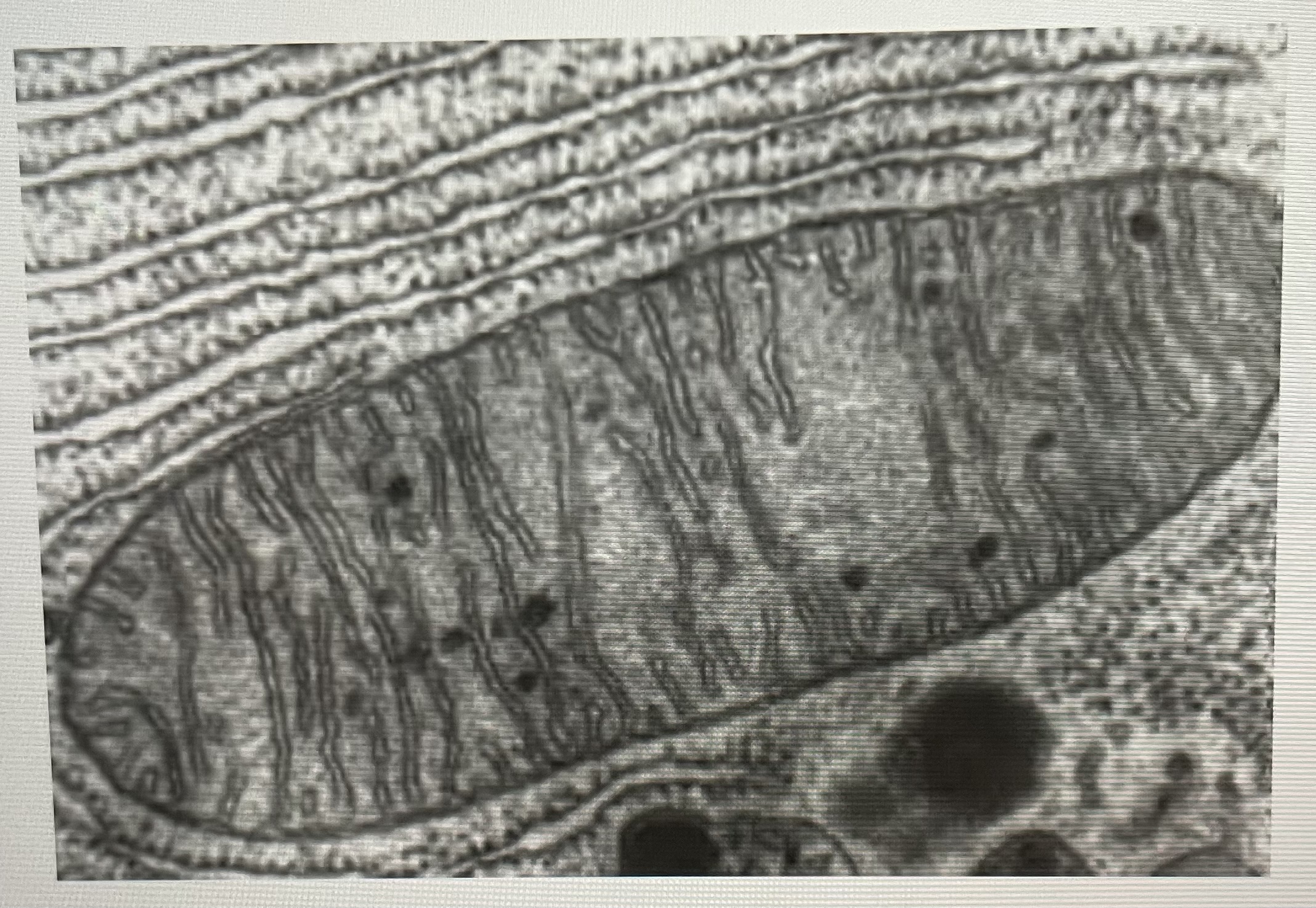 The cell organelle pictures above is a 