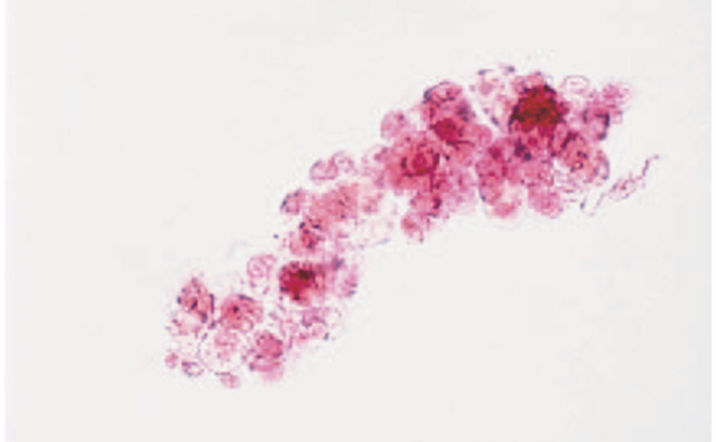 <p>consist of epithelial cells from renal tubules embedded in the hyaline matrix</p>