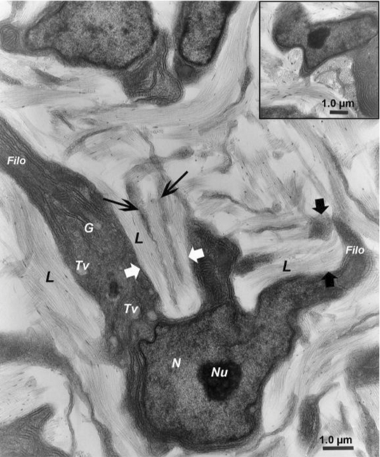 <p>The are long cytoplasmic extensions of keratocytes that surround nascent fibrils and deposit them into forming lamellae </p>