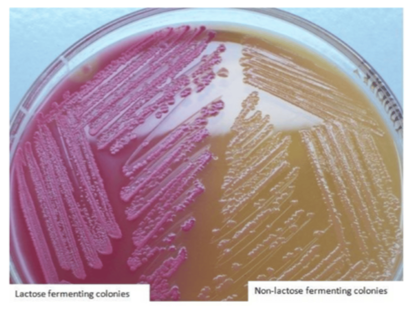 <p>Gram negative bacteria (pink)</p>