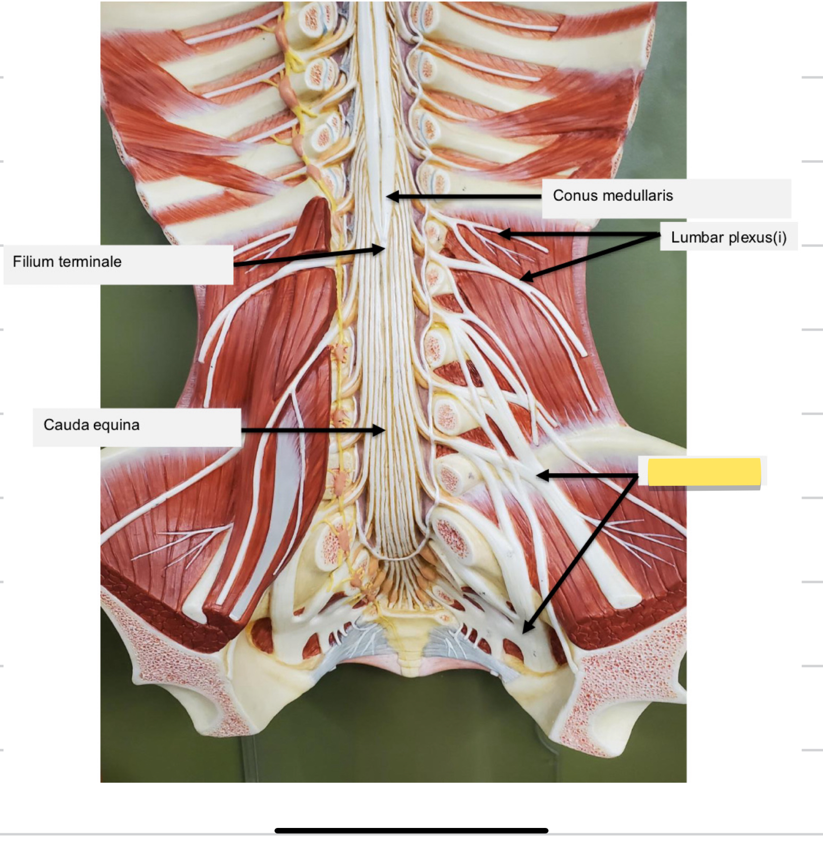 <p>Name this part</p>