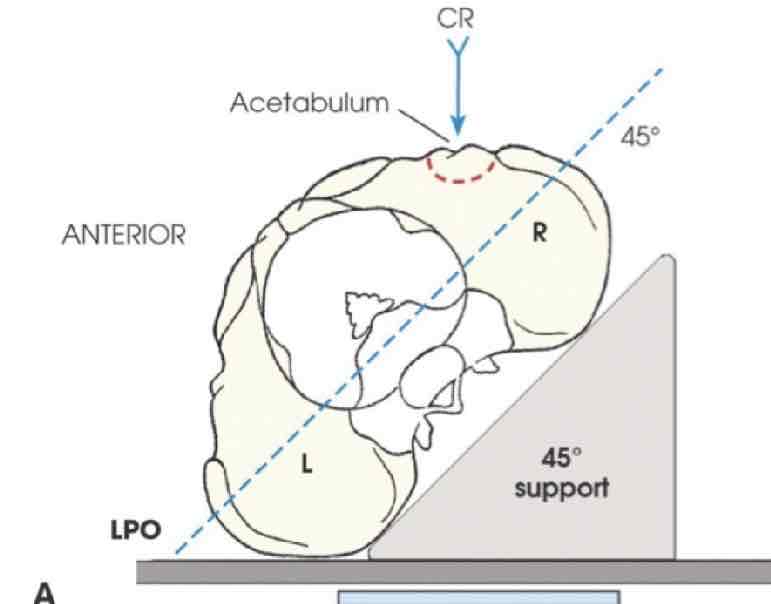 <p>What Projection is this?</p>