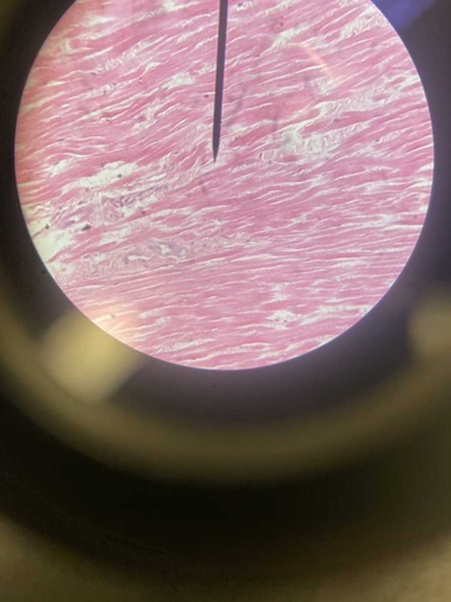 <p>What type of tissue</p>