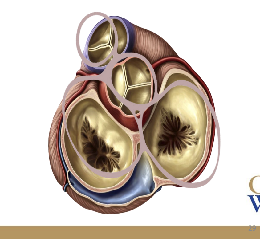 <p>The fibrous skeleton of the heart anchors and provides an attachment point for the cusps of the heart’s valves</p>