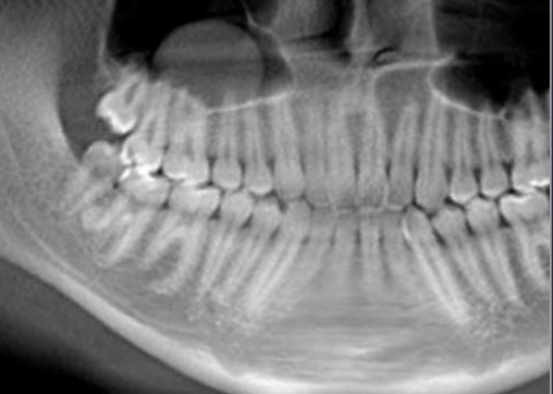 <p>how would you treat this? </p>